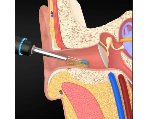 Умная ушная палочка Bebird Smart Visual Earphone M9 Pro, 16 насадок , черный