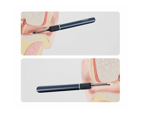 Умная ушная палочка Bebird Ear Visual Picking Stick Note 5, синяя