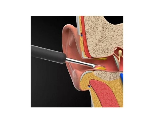 Умная ушная палочка Bebird Smart Visual Spoon Ear Stick R1, белая