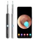 Умная ушная палочка Bebird Smart Visual Spoon Ear Stick R1, белая
